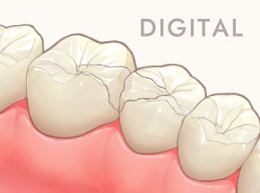 DIGITAL