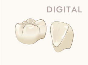 DIGITAL