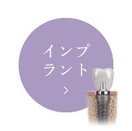 インプラント