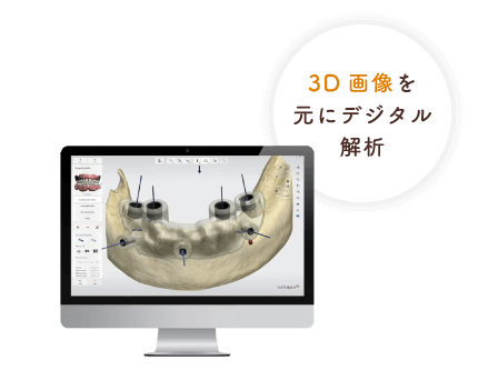3D画像を元にデジタル解析